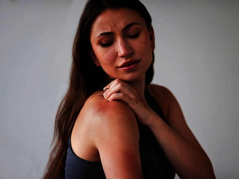 Význam zinku a jeho využitie pri liečbe dermatitídy. Typy podráždenie kože. Periorálna dermatitída liečba